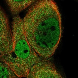 Kinesin C2 Antibody, Novus Biologicals:Antibodies:Primary Antibodies